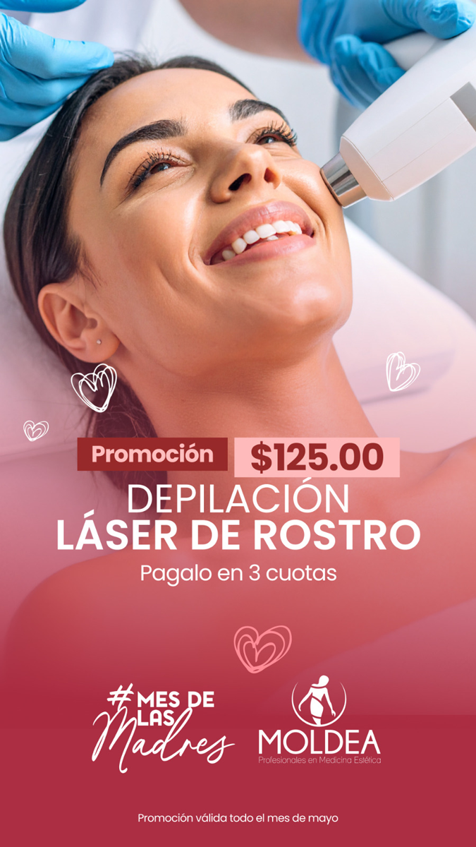 depilacion-laser-rostro-elsalvador depilacion laser de rostro en el salvador